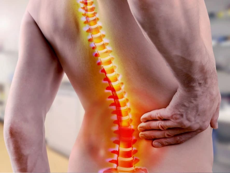 Spinal Fusion Surgery Abroad