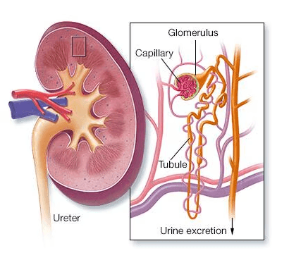 Nephrotic Syndrome medical condition