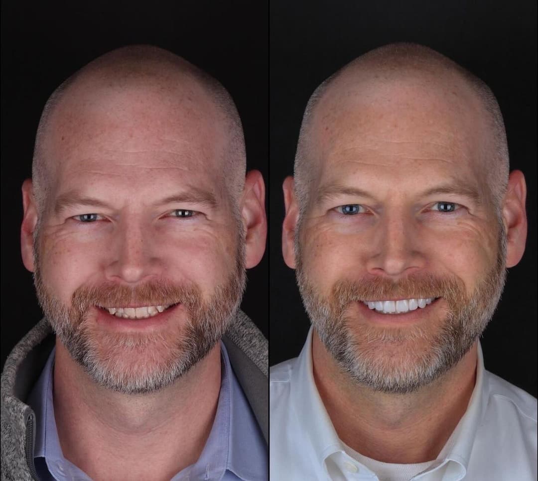 Before/After image 1