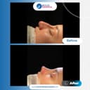 Bolge Hospital Turkey - Before/After 3