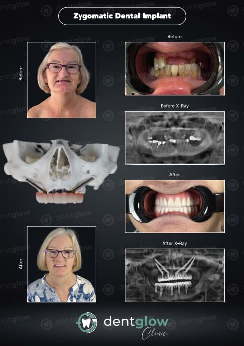 Before/After image 1