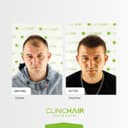 Clinichair - Before/After 2