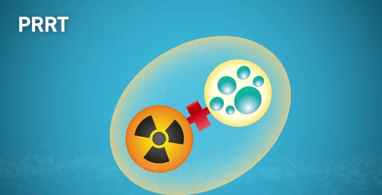 Lutetium treatment of Neuroendocrine Tumors (NETs) medical condition