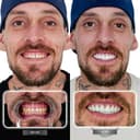 Dent Glow Clinic - Before/After 3