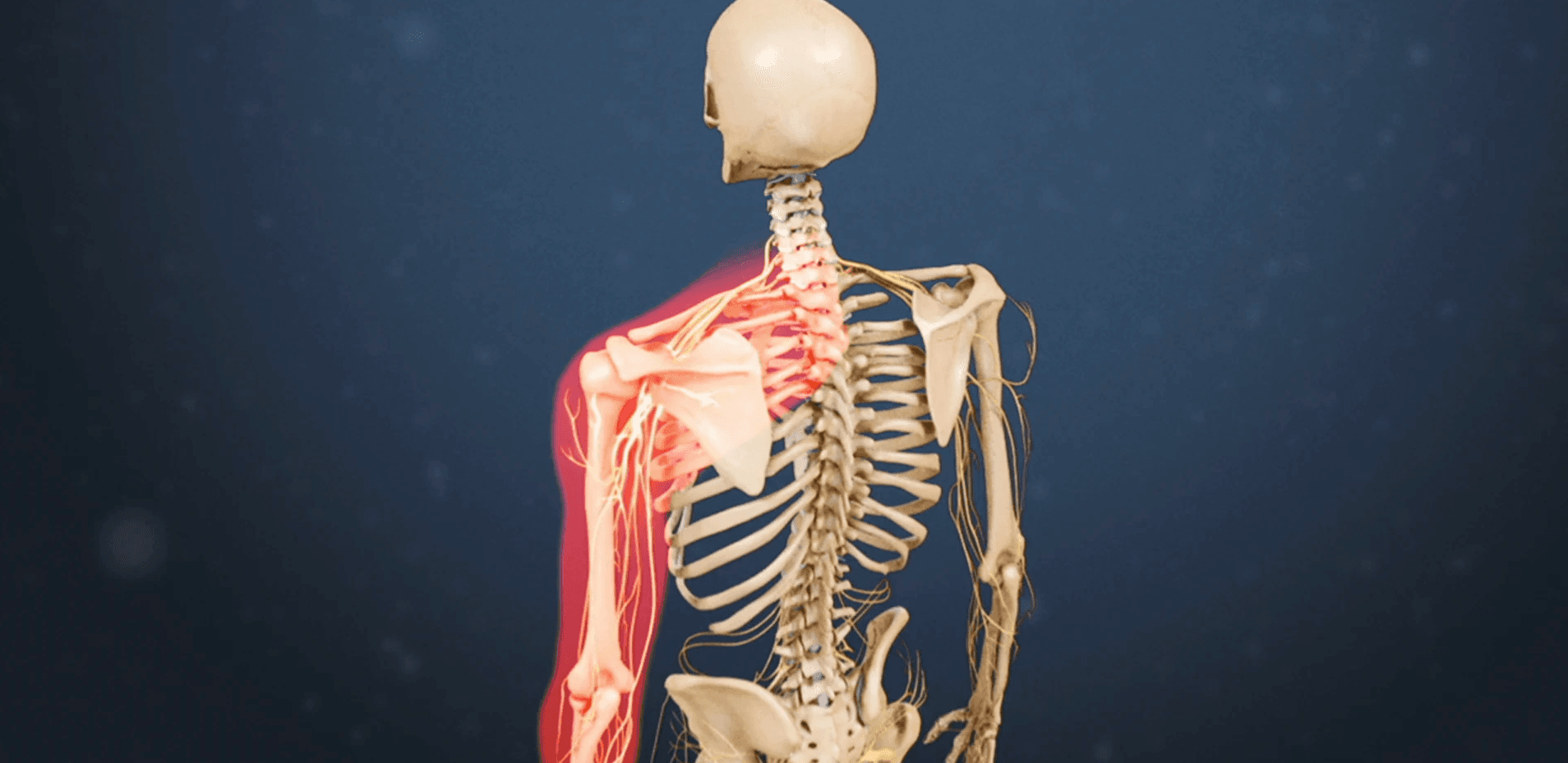 Cervical herniated disc medical condition