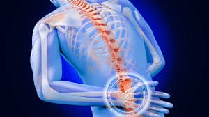 Failed Back Surgery Syndrome medical condition