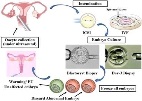 Preimplantation genetic diagnosis (PGD) medical condition