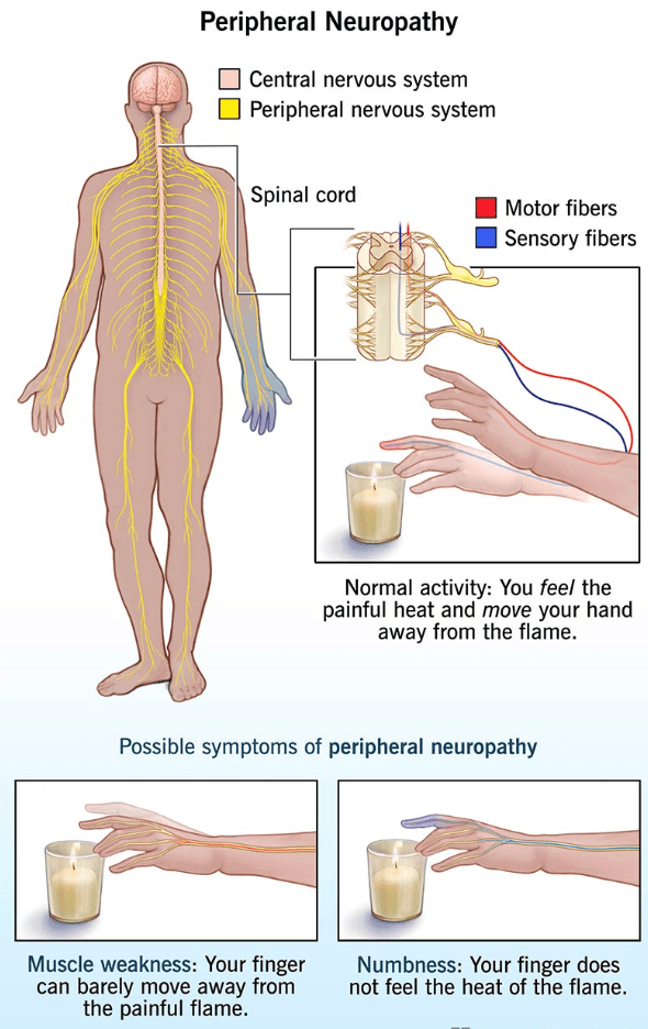 Peripheral Nerve Damage medical condition
