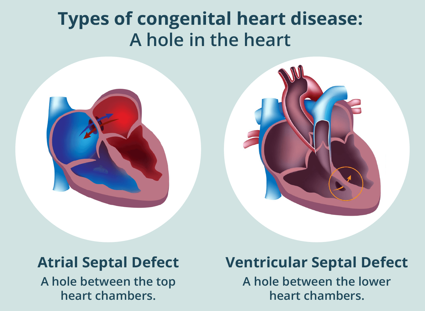 Congenital and Acquired Heart Defects medical condition