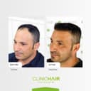 Clinichair - Before/After 4