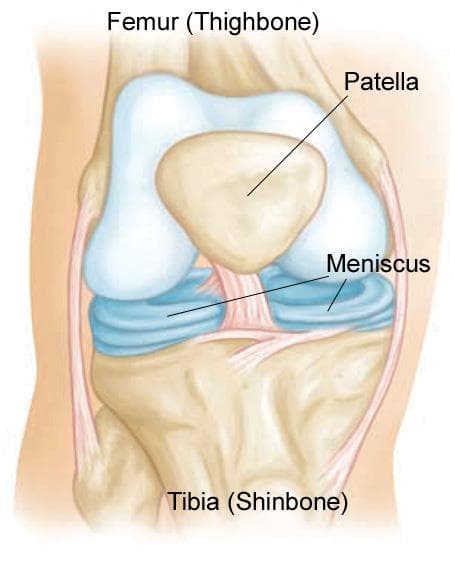 Meniscal Tears medical condition
