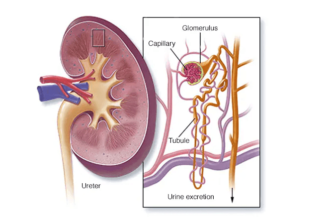 Lupus Nephritis medical condition