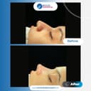 Bolge Hospital Turkey - Before/After 4