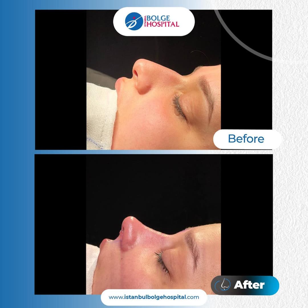 Before/After image 1