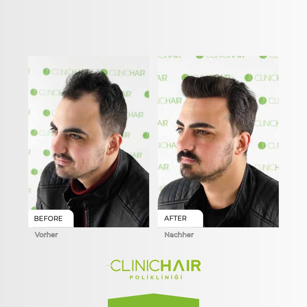 Before/After image 1