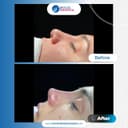 Bolge Hospital Turkey - Before/After 2