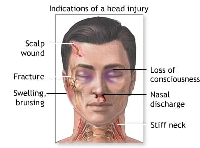 Head Traumas medical condition