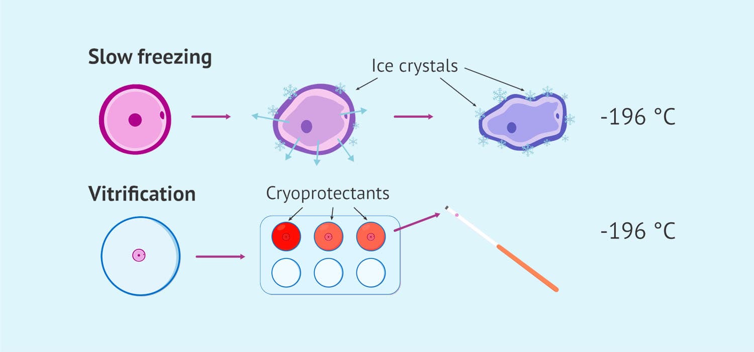 Egg and embryo vitrification medical condition