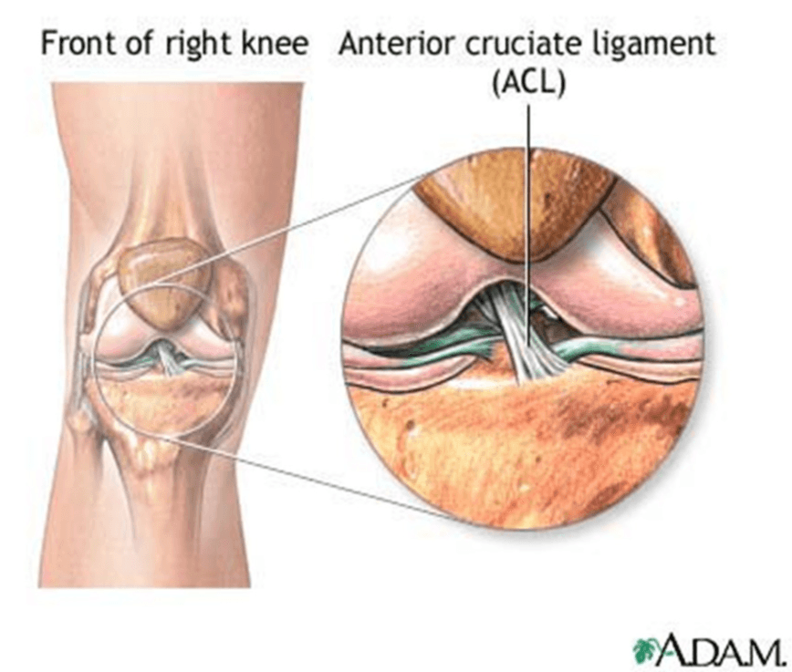 Knee ACL Injury medical condition