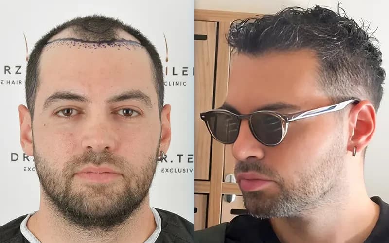 Before/After image 1