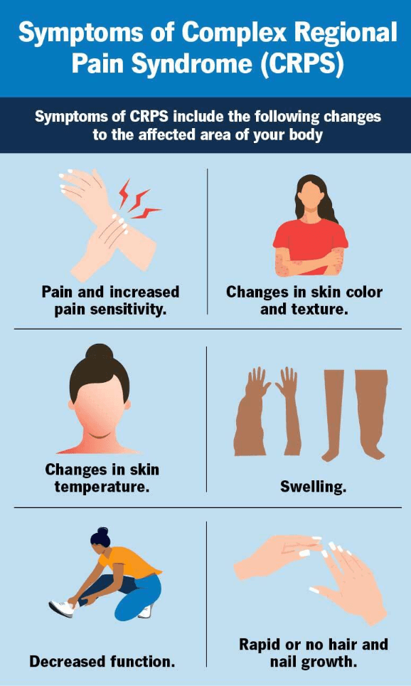 Complex Regional Pain Syndrome medical condition