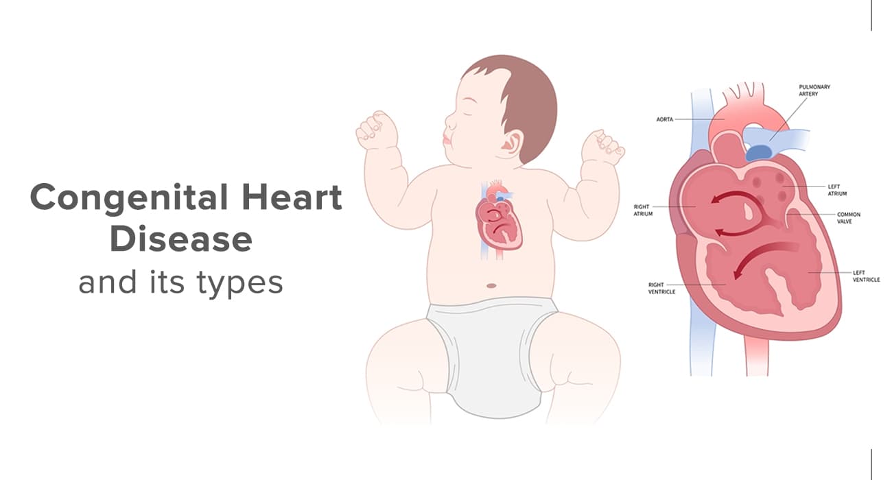 Congenital Heart Diseases medical condition