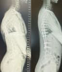 Liv Hospital - Before/After 3