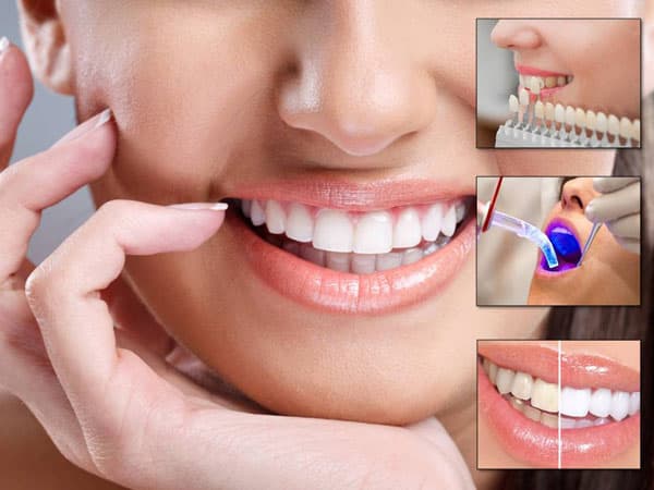 Dental Treatment medical condition