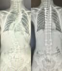 Liv Hospital - Before/After 4