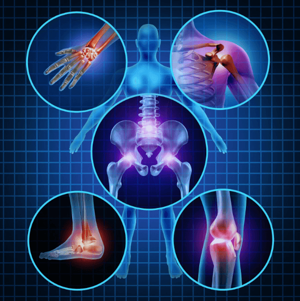 Orthopedics medical condition