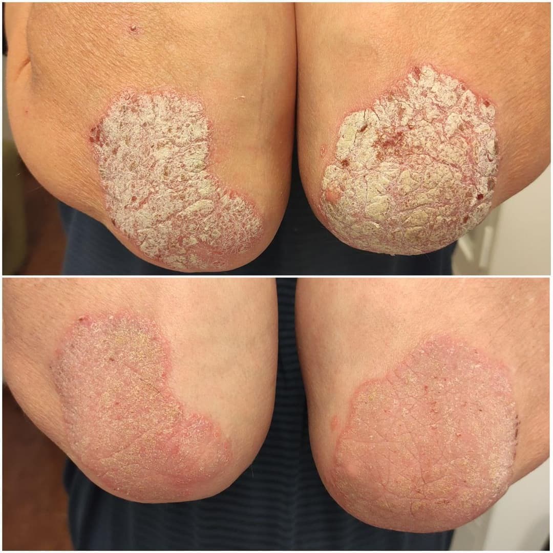 Before/After image 1