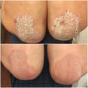 Gashaltı Health Hotel Naftalan - Before/After 1