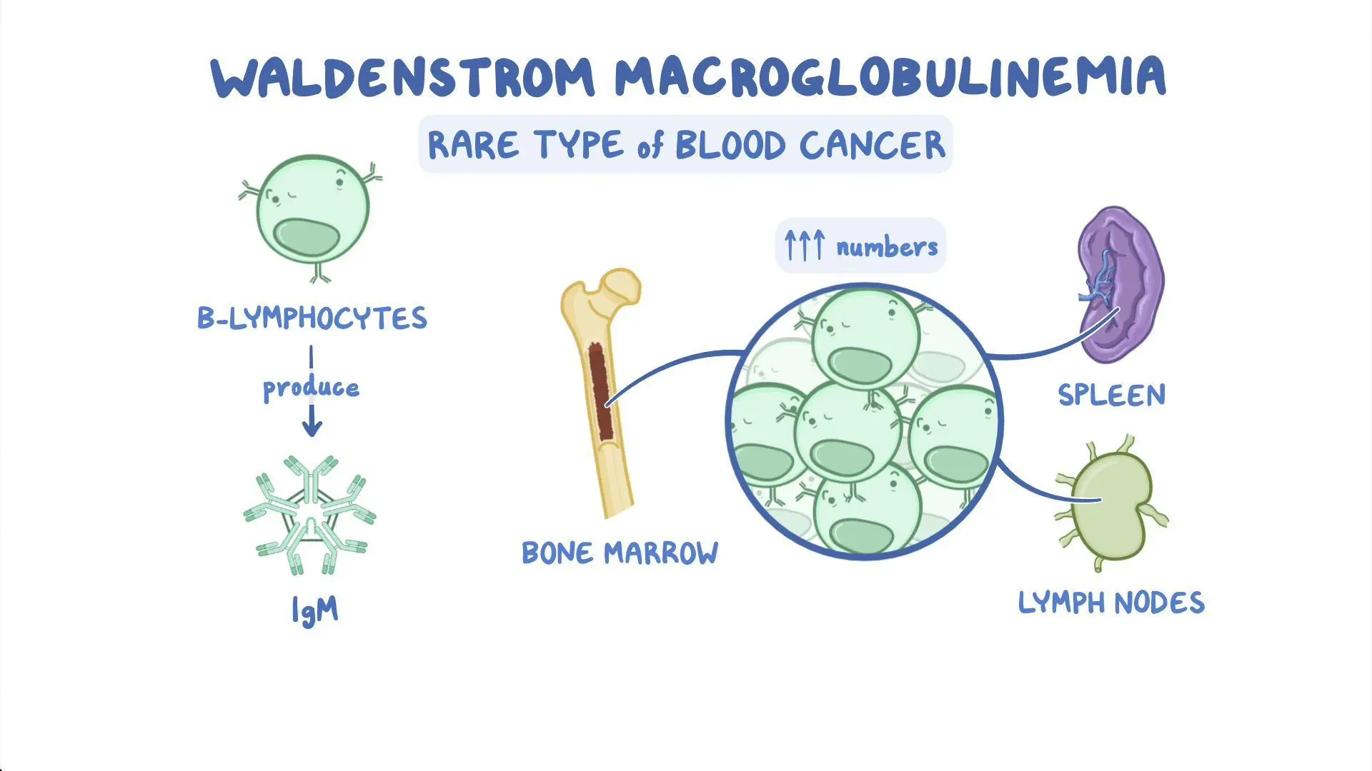 Waldenström Macroglobulinemia medical condition