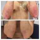 Gashaltı Health Hotel Naftalan - Before/After 2