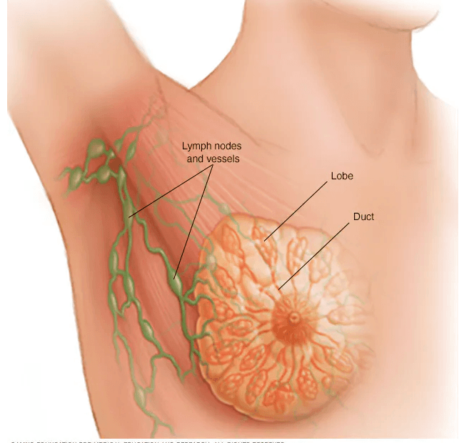 Breast Cancer medical condition
