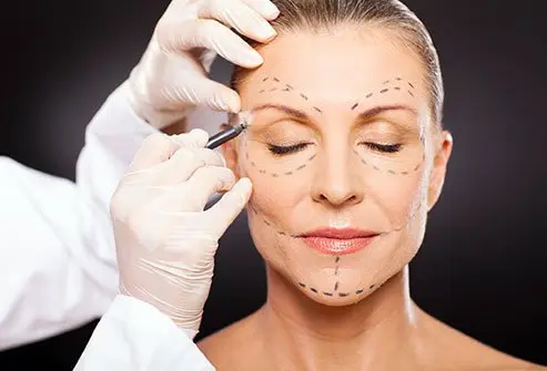 Plastic Surgery medical condition
