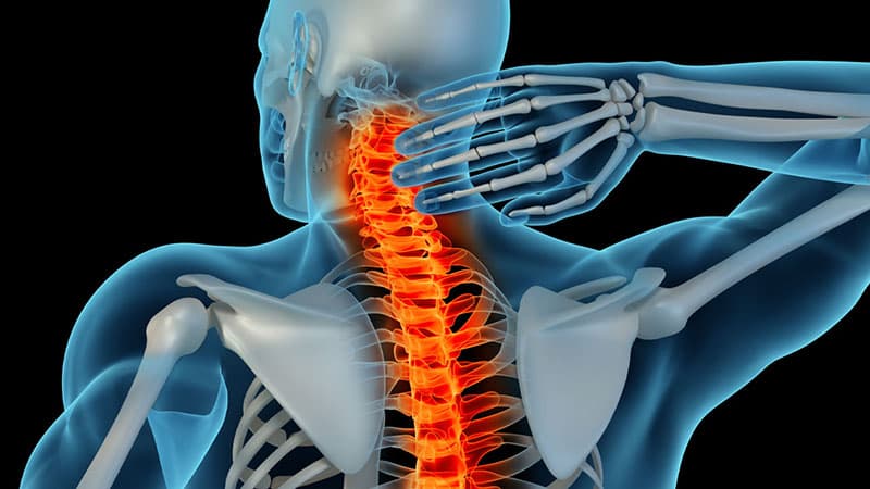 Spinal cord stroke medical condition