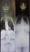 Liv Hospital - Before/After 2