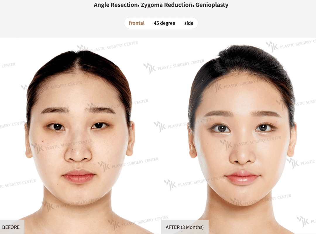 Before/After image 1