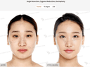 JK Plastic Surgery Center - Before/After 1