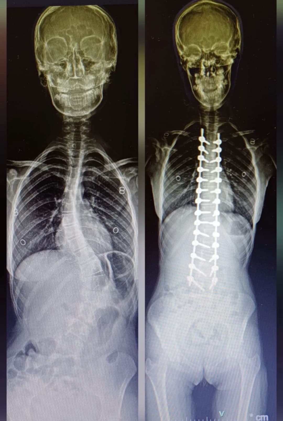 Before/After image 1