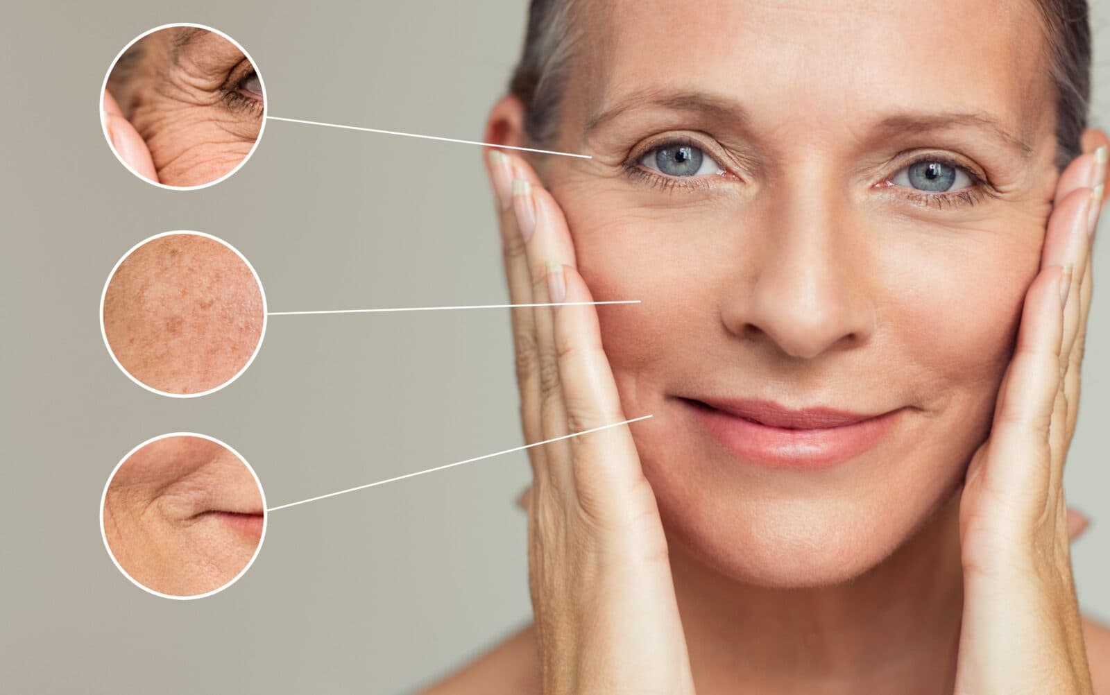 Anti-aging medical condition
