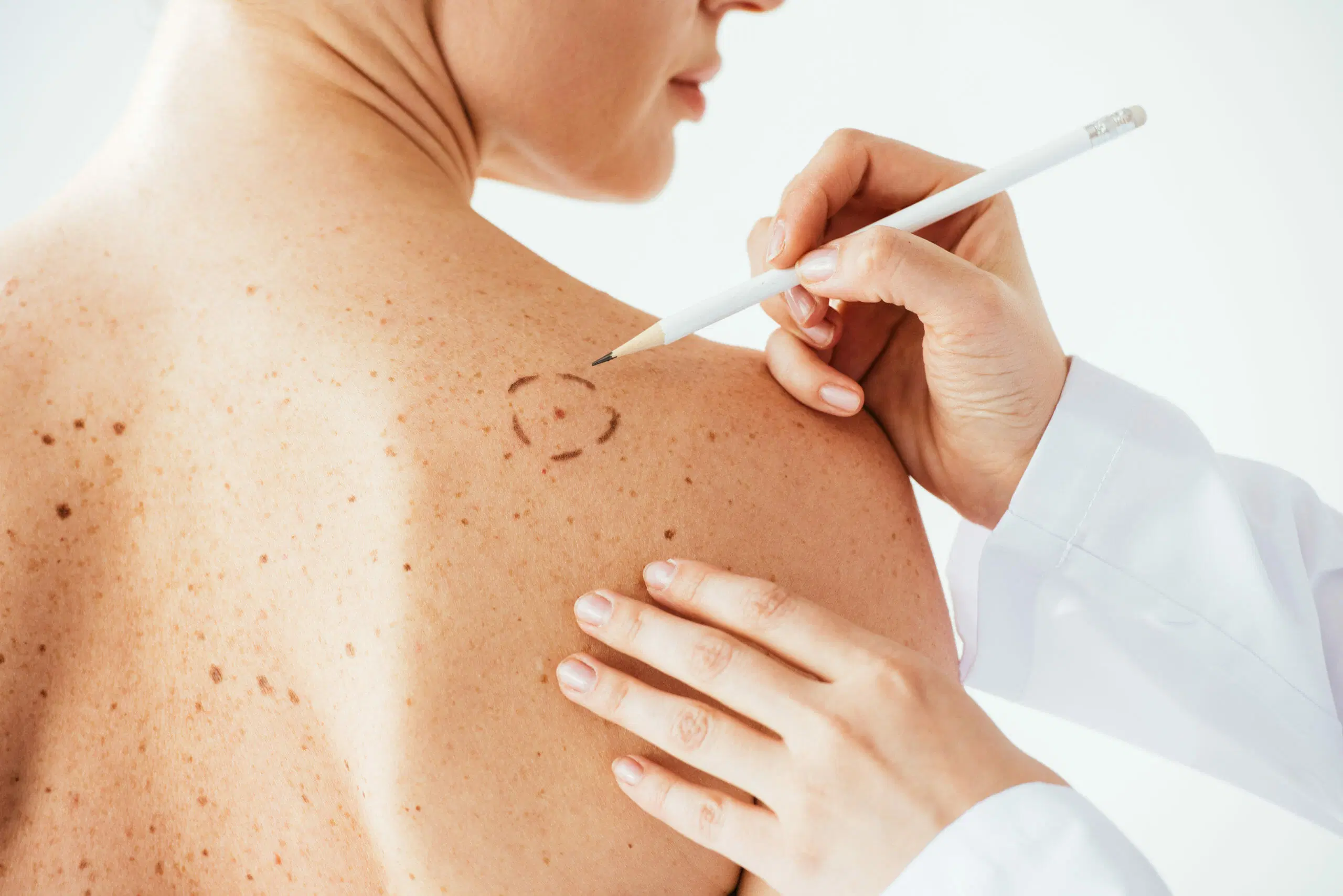 Dermatology medical condition