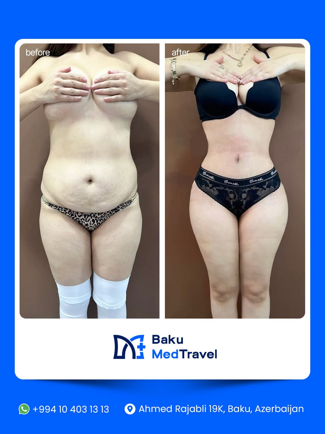 Before/After image 1