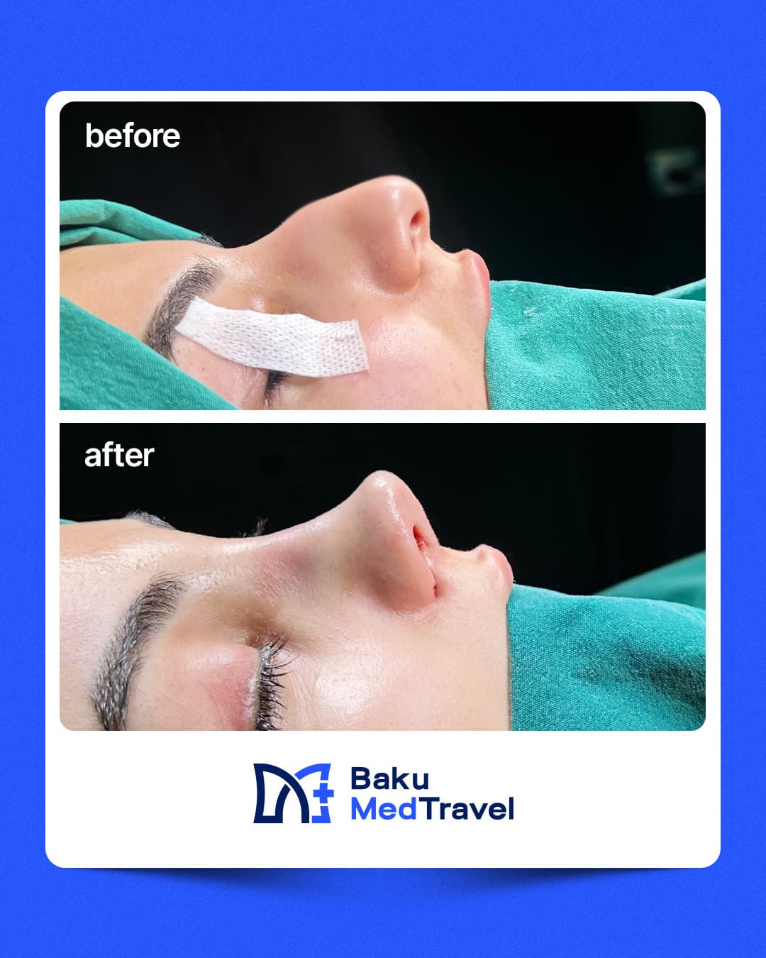 Before/After image 1