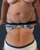 La Clinic - Before/After 2