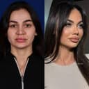 National Prime Hospital - Before/After 3