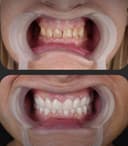 Özel Abat Medical Center - Before/After 2