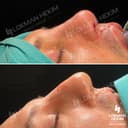 Lokman Hekim Health Group - Before/After 4