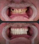 Özel Abat Medical Center - Before/After 4